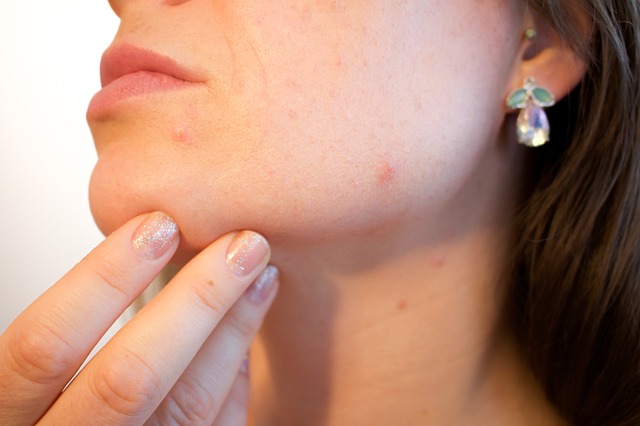 best vitamins for skin vitamin e skin defence acne scar