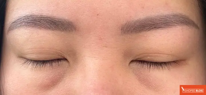 before xlash eyelash growth serum review